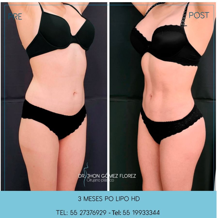 Jhon César Gómez Florez-26