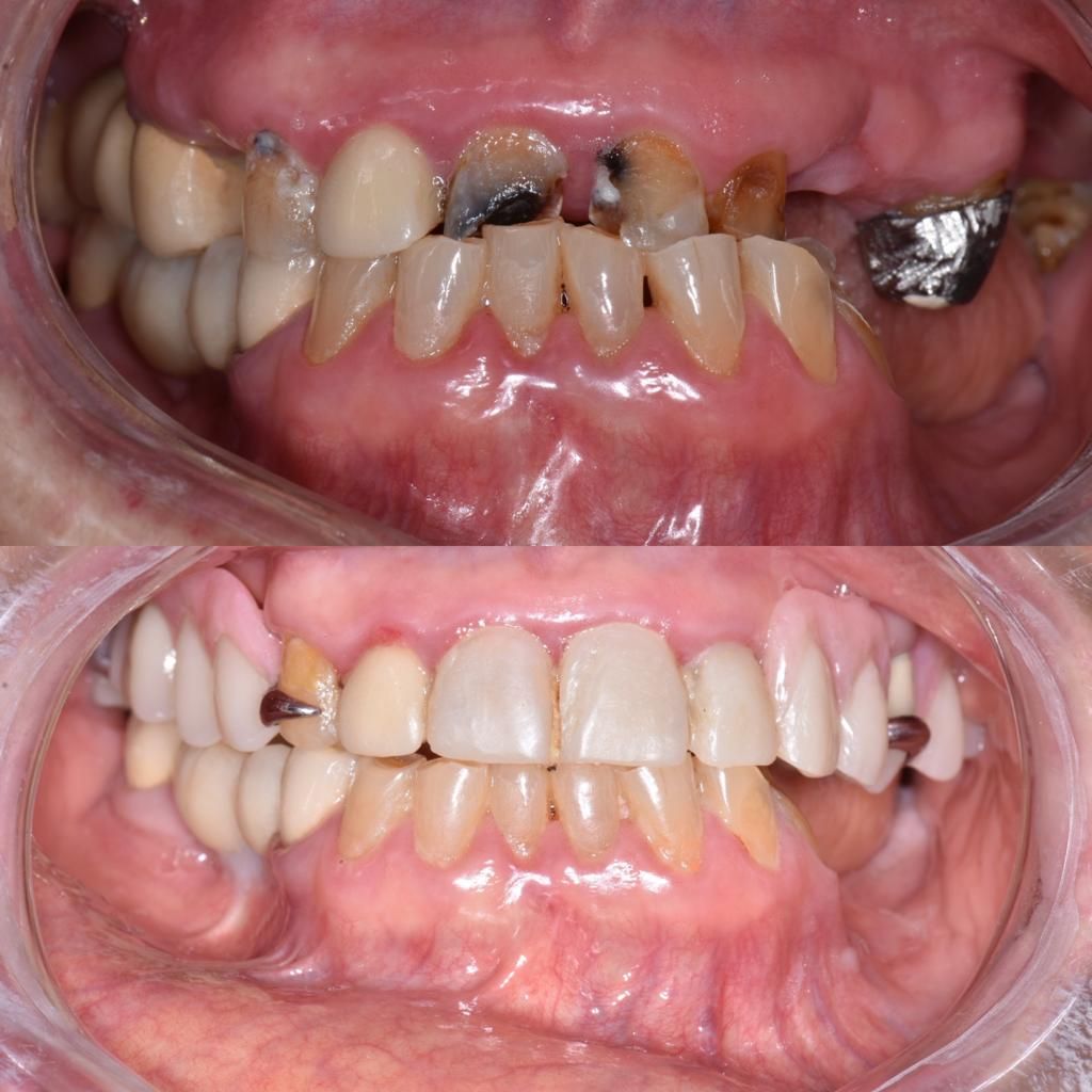 Andrea Moncada Rmz-14