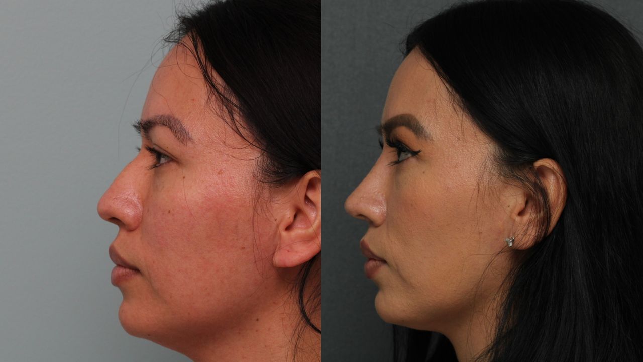 Angel Castro Urquizo-154