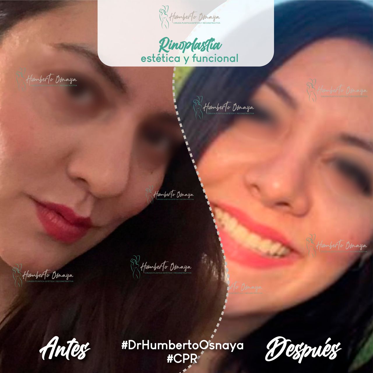 Humberto Osnaya Moreno-28