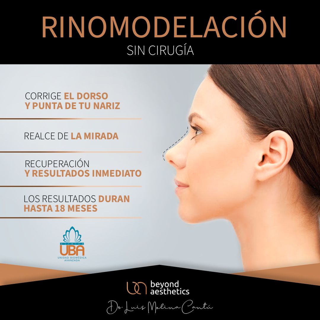 Luis Molina Cantú-15