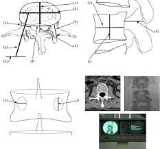 Enrique De Obieta Cruz-42