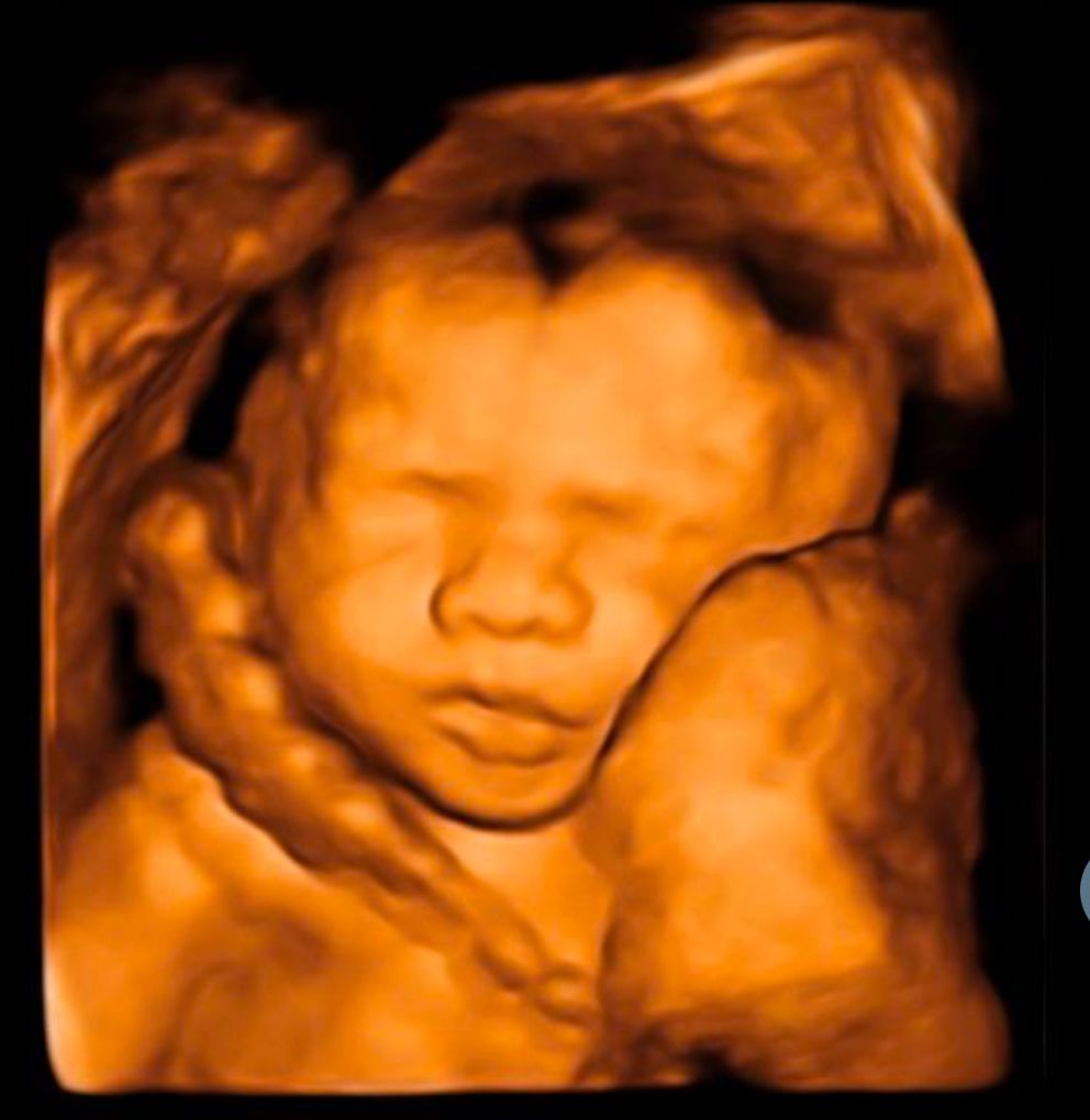 Cesar Octavio Mercado Sahagun-8