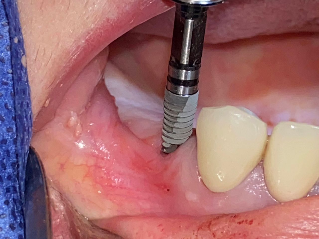 Georgina Zurita Rdz-3