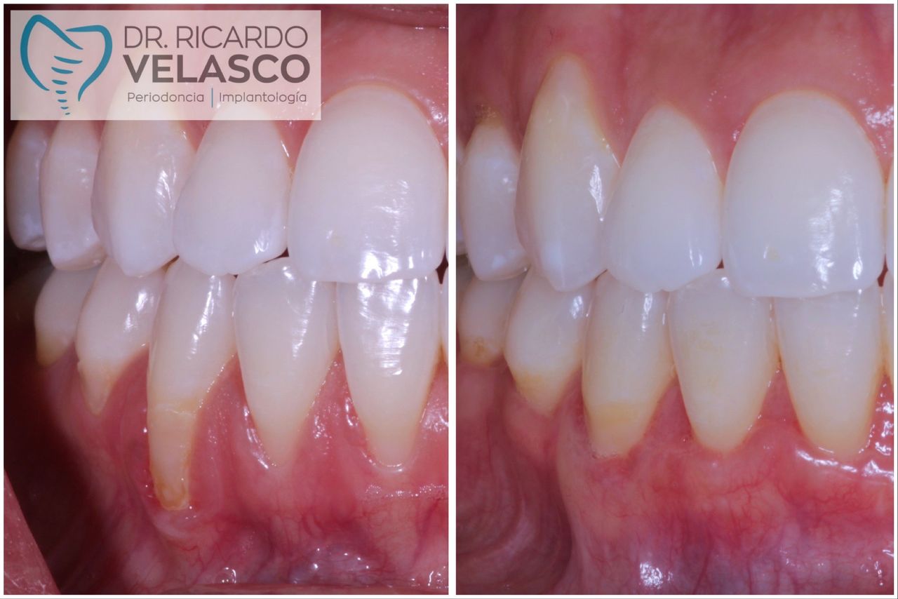 Ricardo Velasco Avelar-12