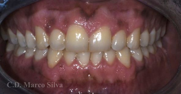 Marco Antonio Silva-11