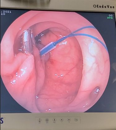 J. César Reyes Vásquez-30