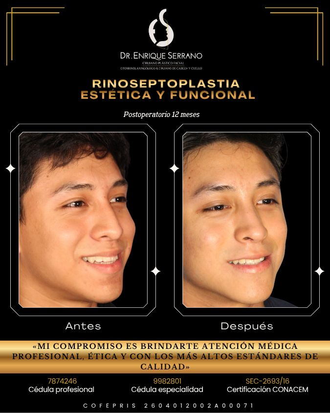 Enrique Serrano Cruz-1
