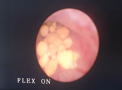 Efrain Barradas Huervo-8