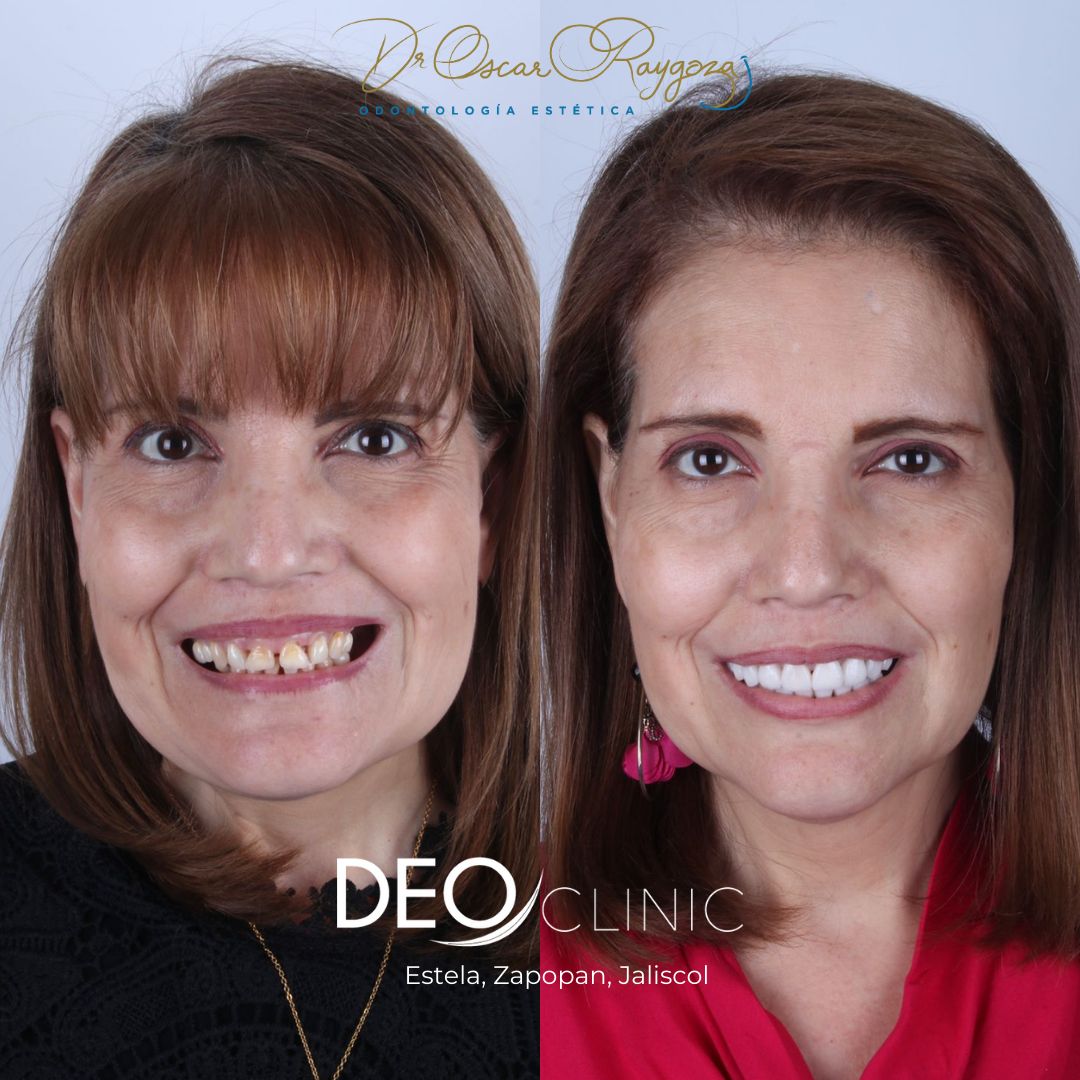 Oscar Raygoza Carrillo-36