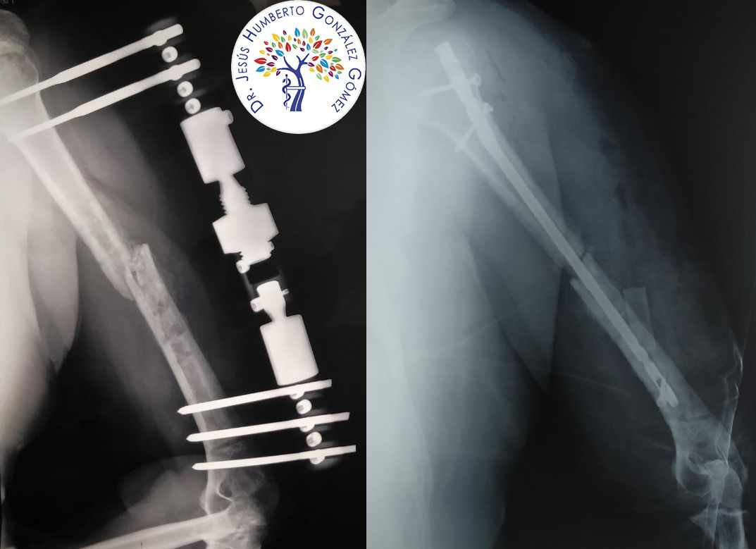 Jesús Humberto González Gómez-4