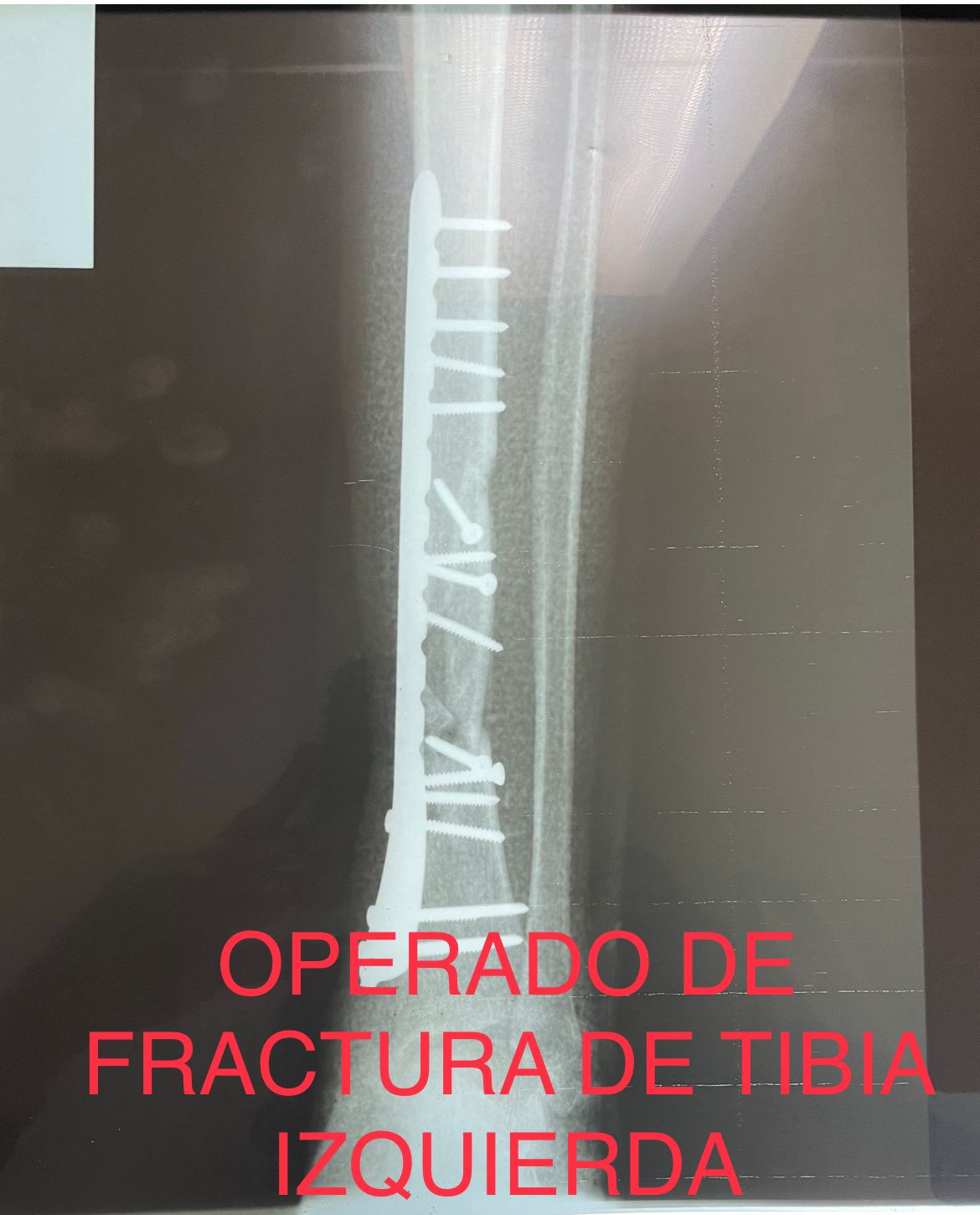 Emmanuel Bolaños Cortes-29