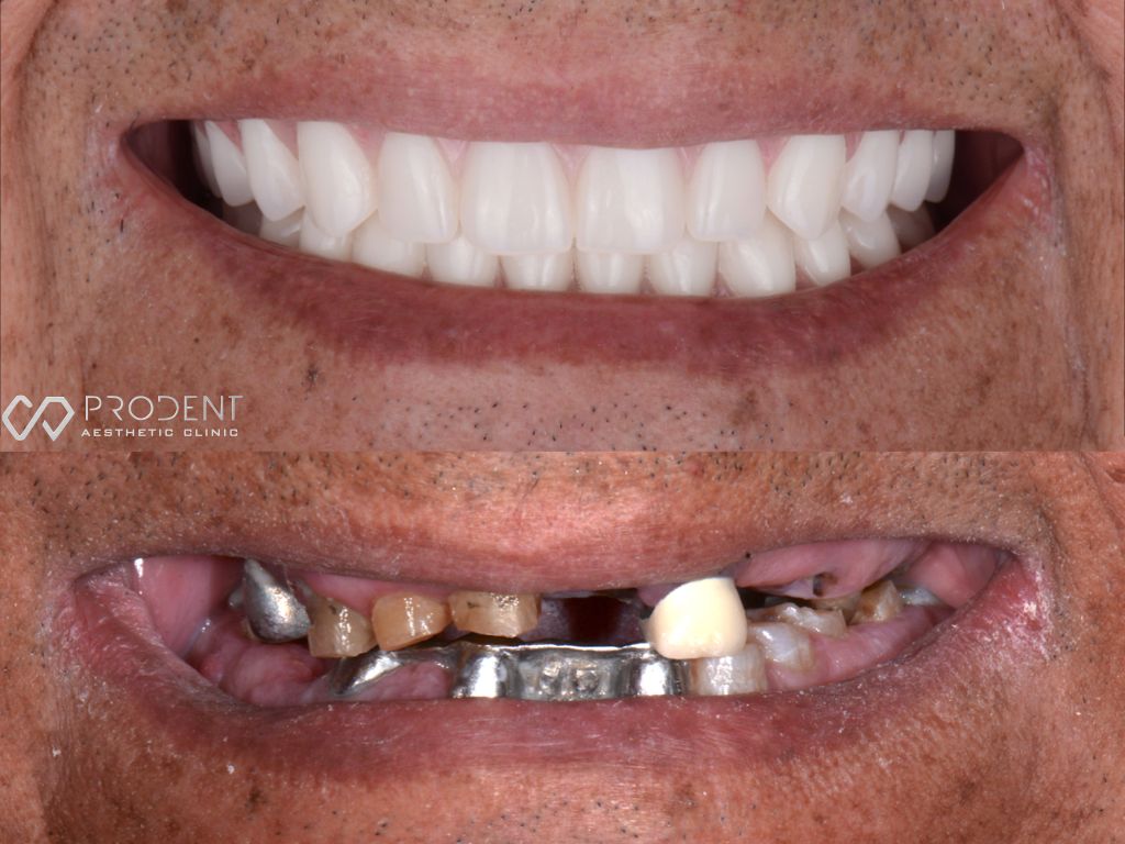 Ulises Pérez Murillo-102