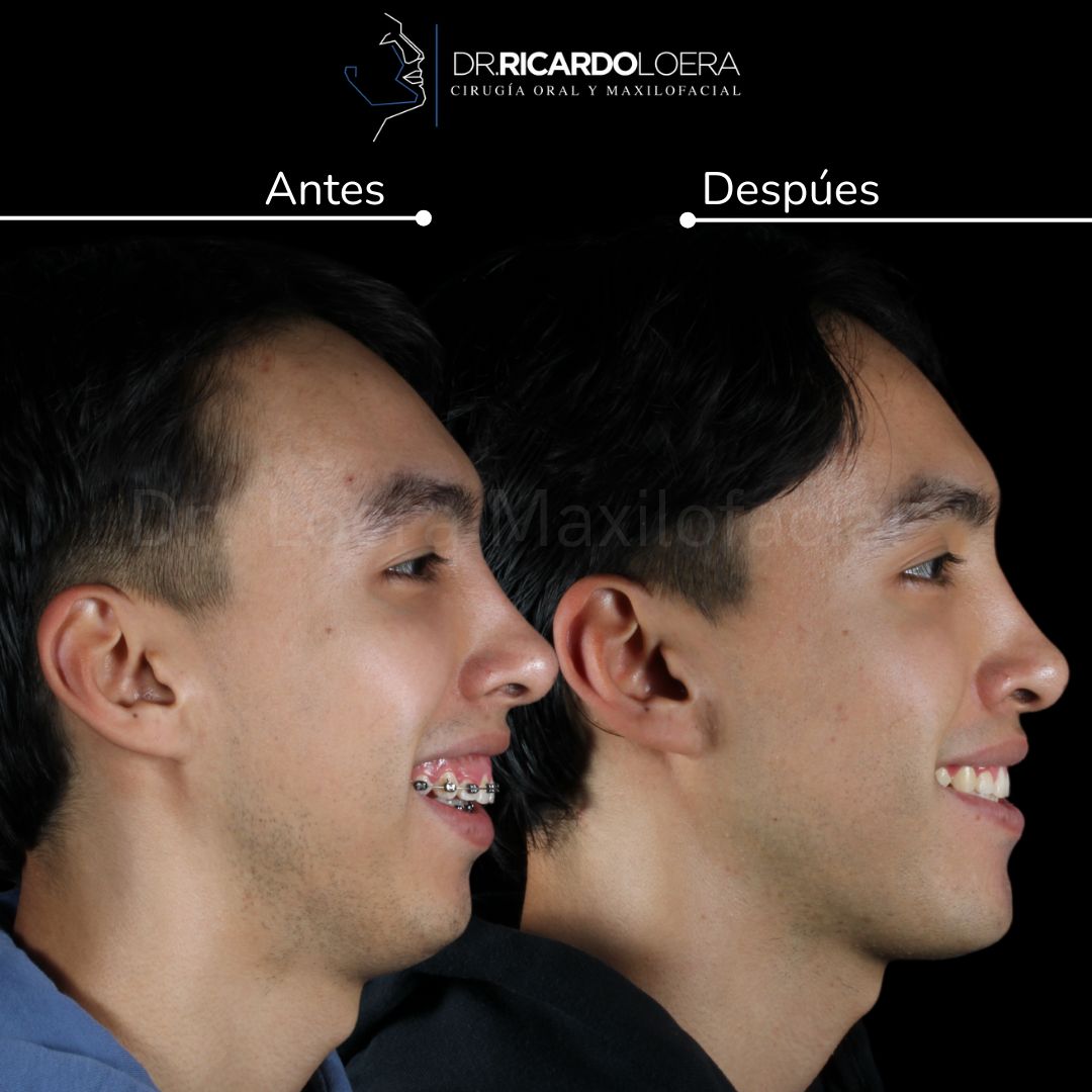 Ricardo Loera Morales-10