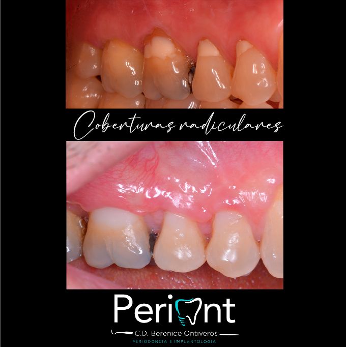 Berenice Ontiveros-2