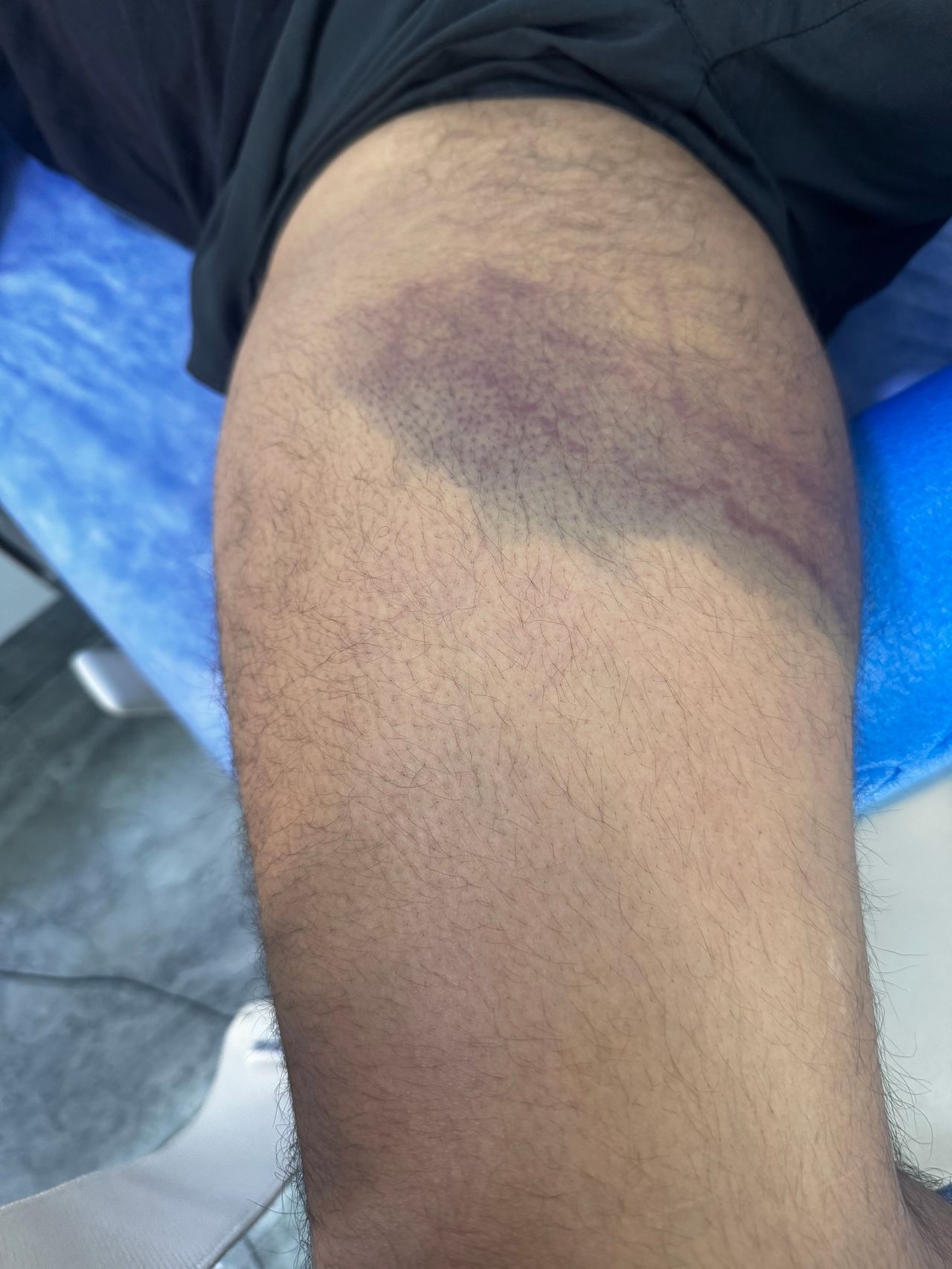 Irving Denilson Peña González-35