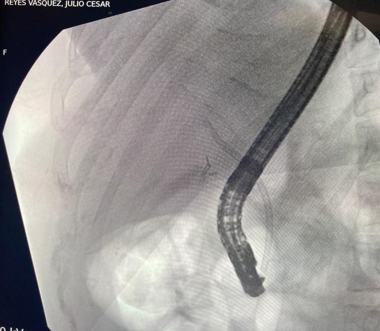 J. César Reyes Vásquez-21