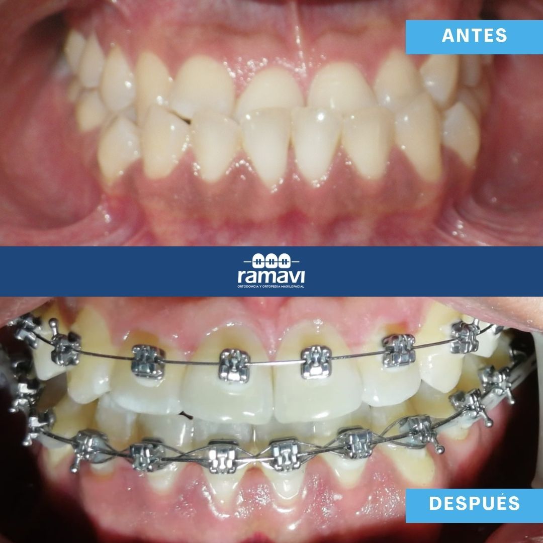 Ramon Mayorga Villeda-5