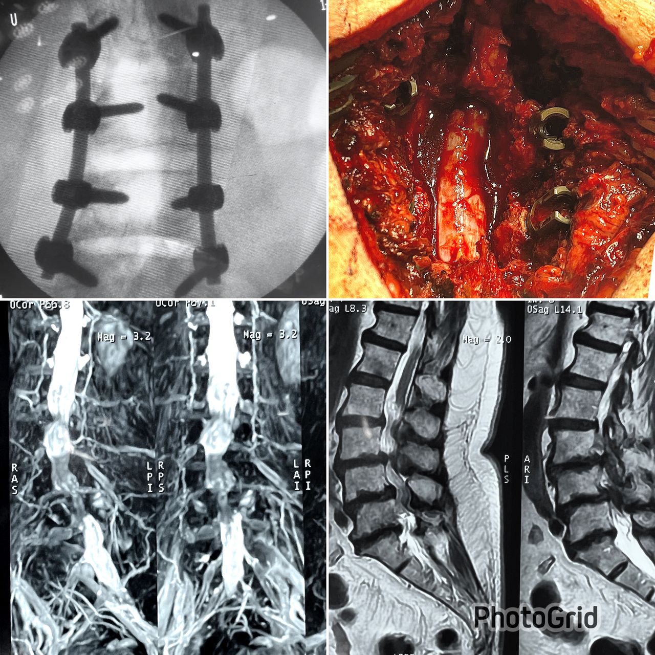 Avelino Aguilar Merlo-0
