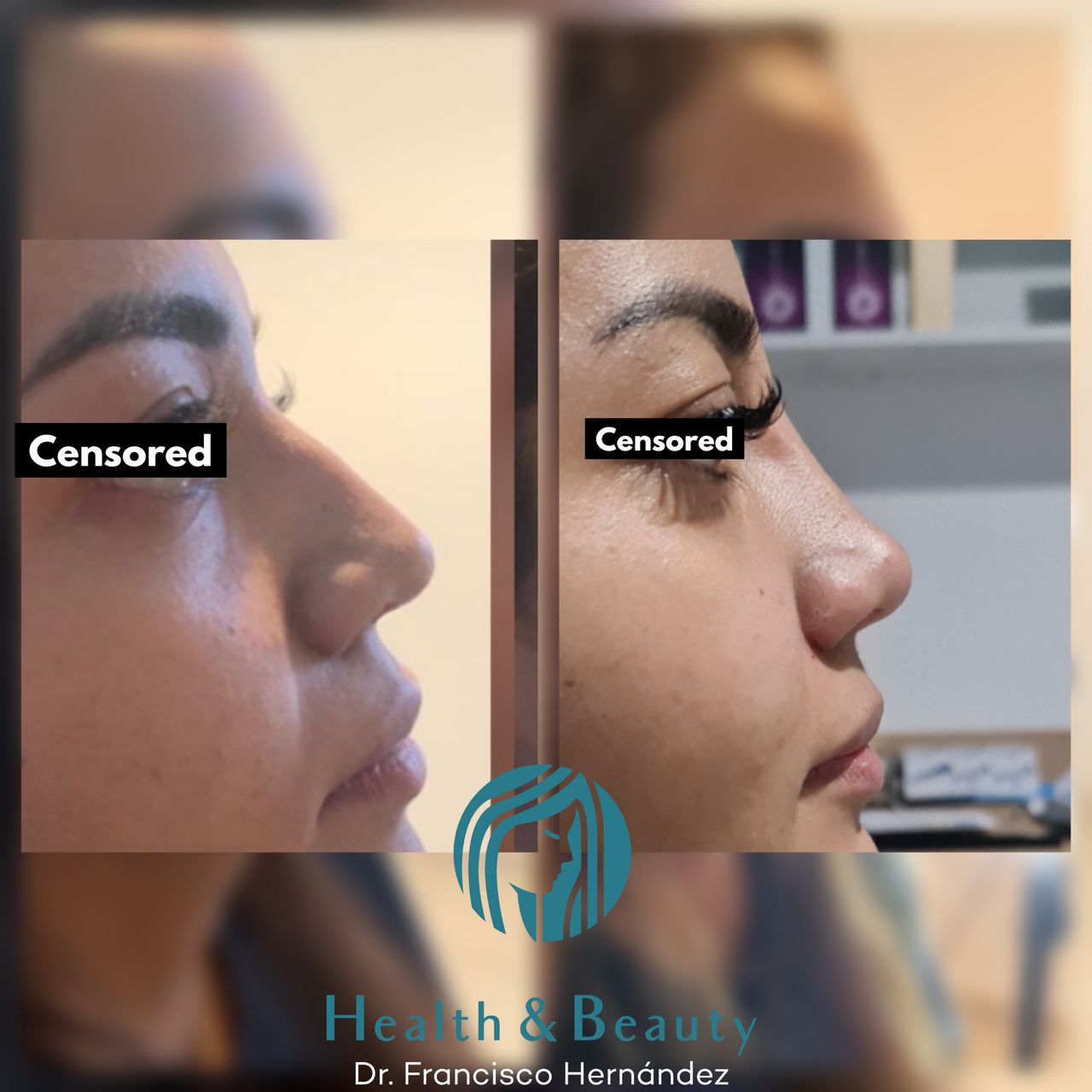 Francisco Hernández Gómez Crespo-93