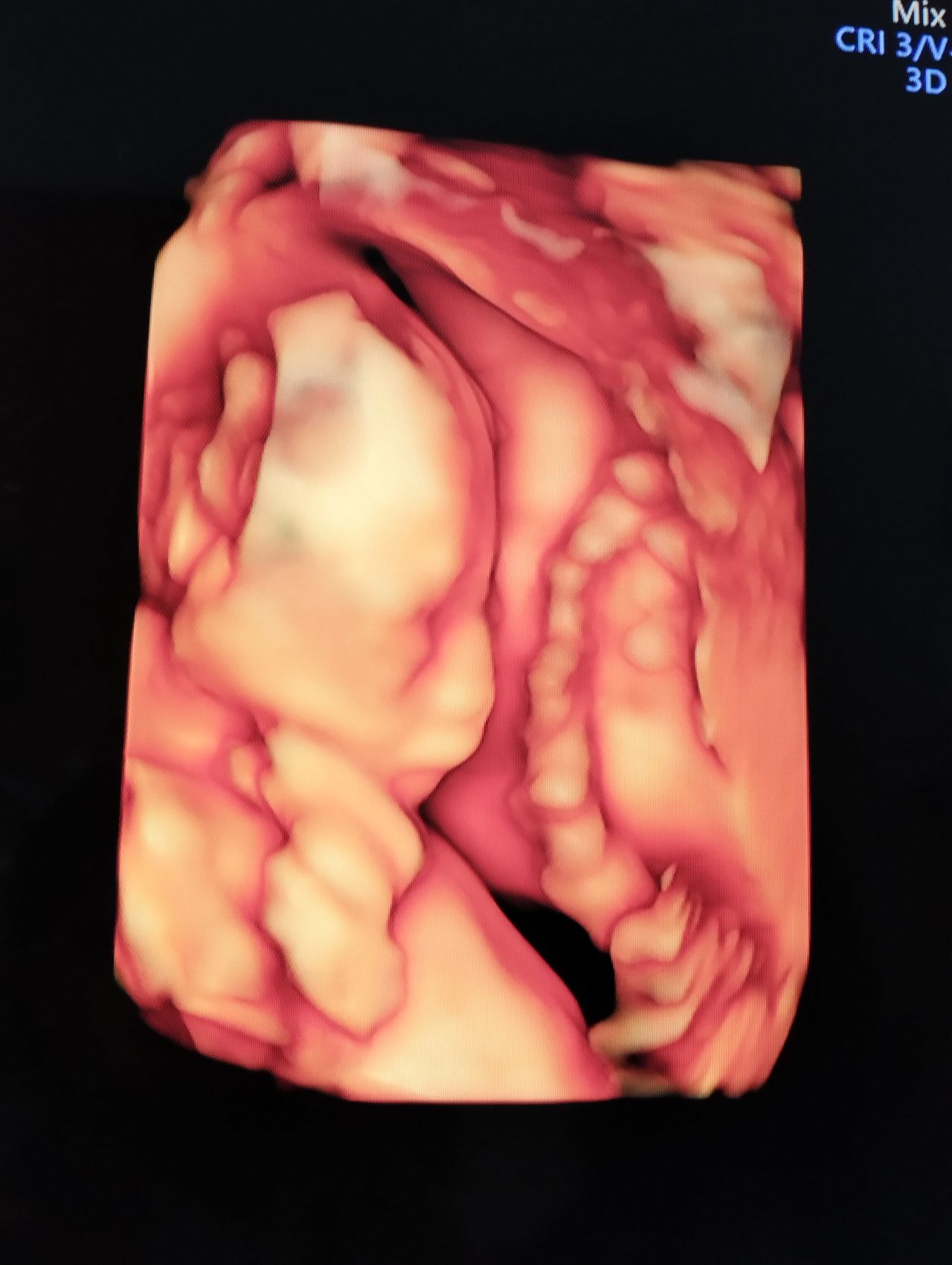 Abraham Ignacio Pérez De La Rosa-24