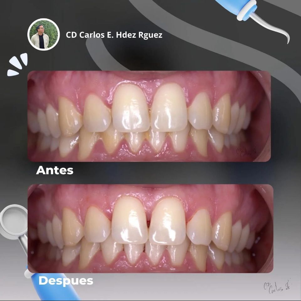 Carlos Enrique Hernández Rodríguez-23