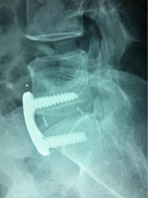 Simón Almanza Mendoza-4