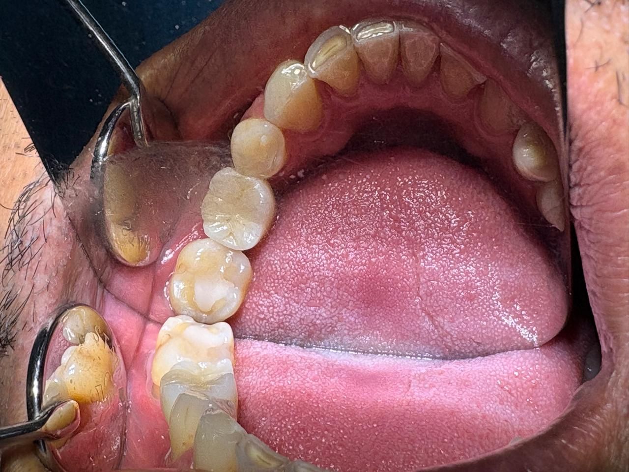 Arturo Romero Grande-37