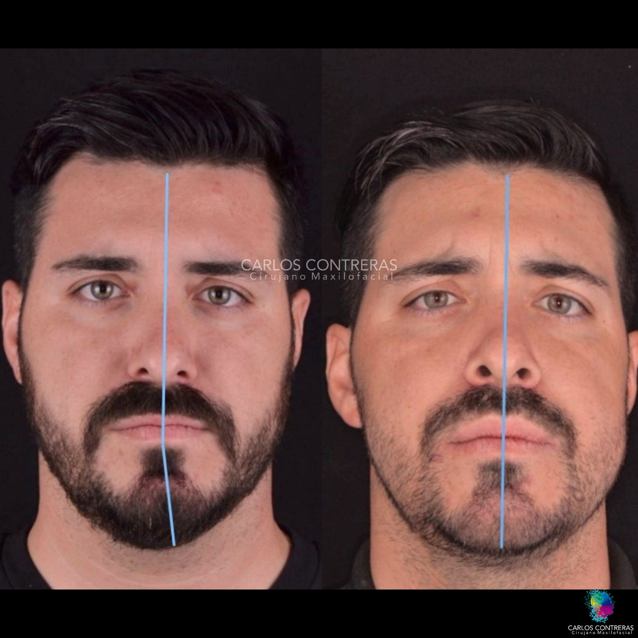 Carlos Ernesto Contreras Castellanos-32