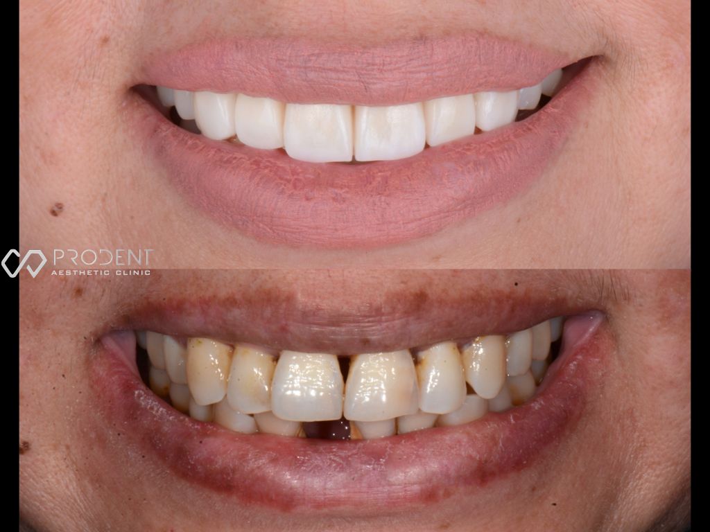 Ulises Pérez Murillo-96