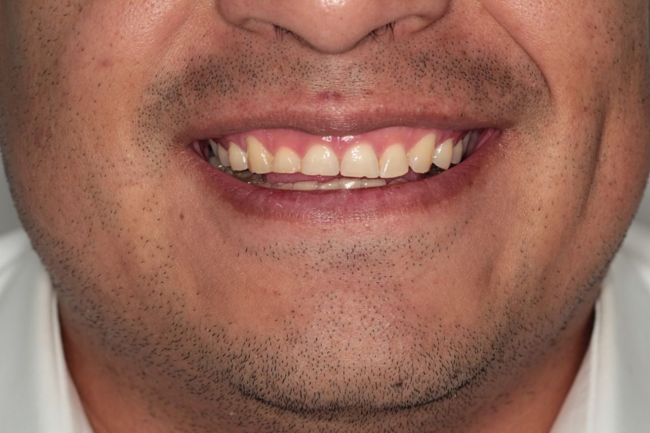 Mariel Itzayani Torres López-22