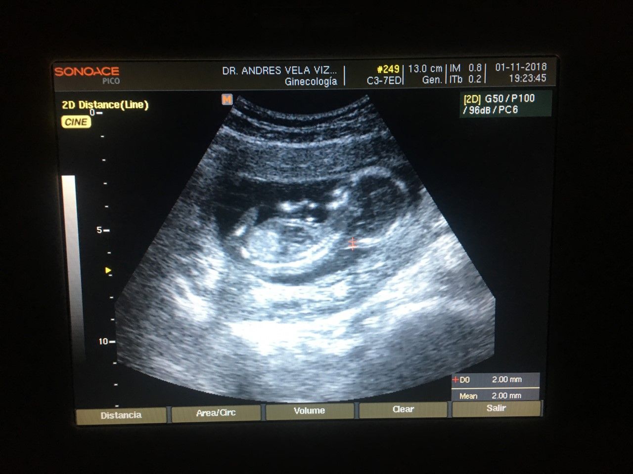 Andrés Vicente Vela Vizuet-30