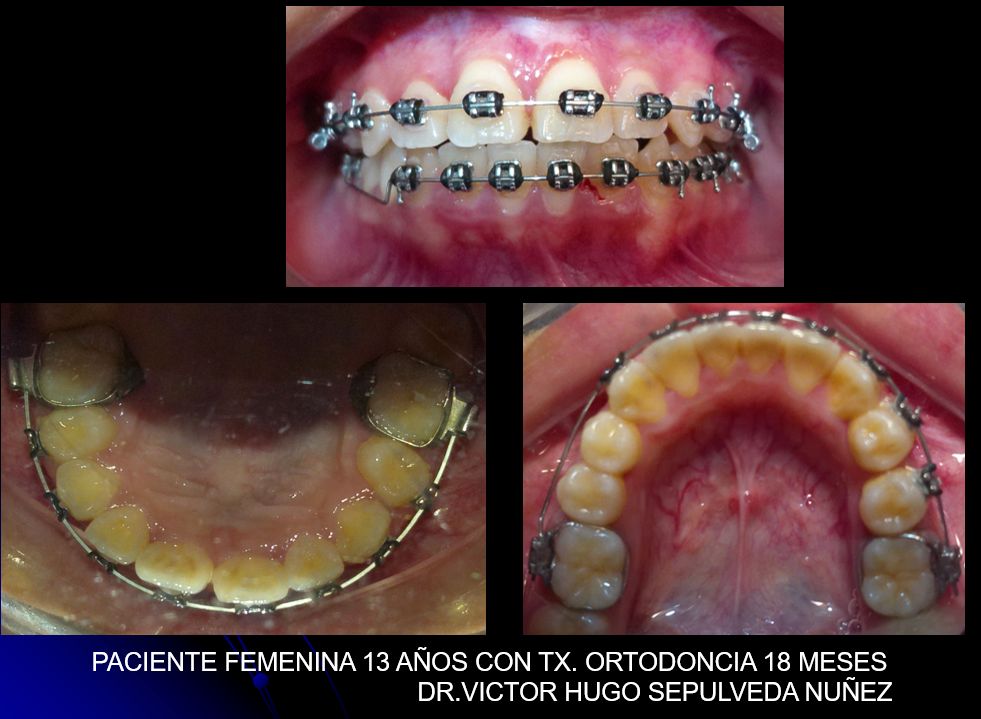 Victor Hugo Sepulveda Núñez-7