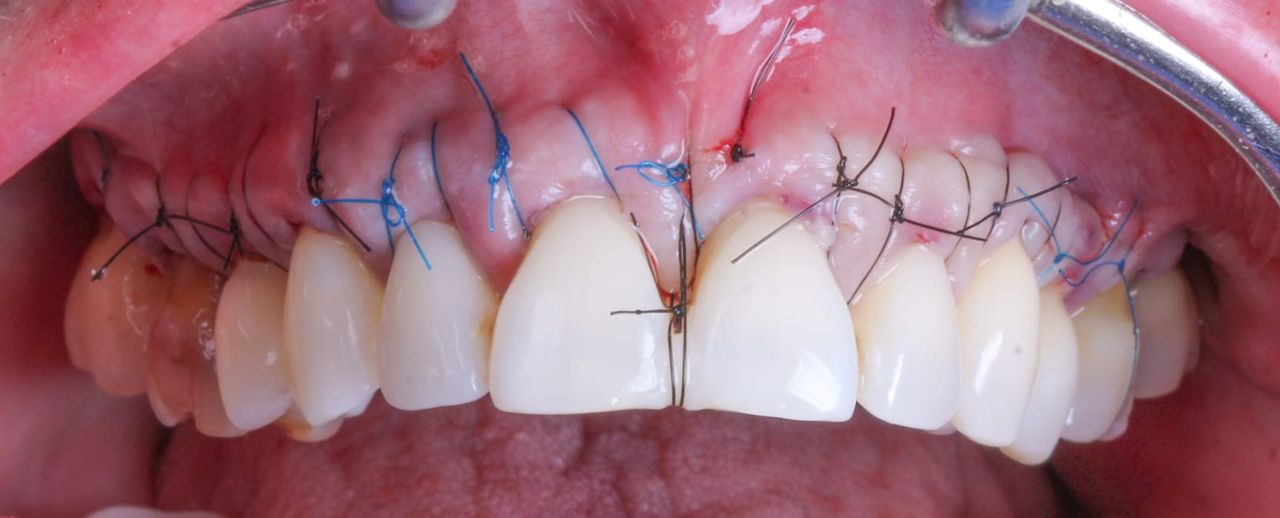 Hugo Enrique Aguilar Lamas-20