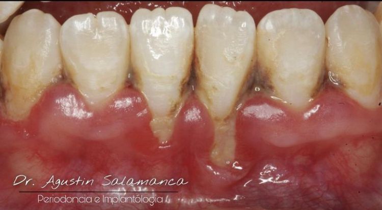 Agustin Salamanca Tapia-26