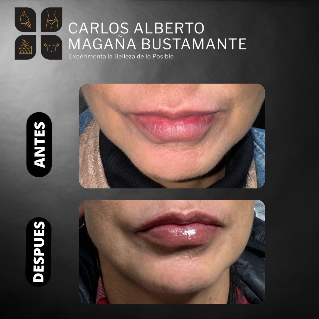 Carlos Alberto Magaña Bustamante-14