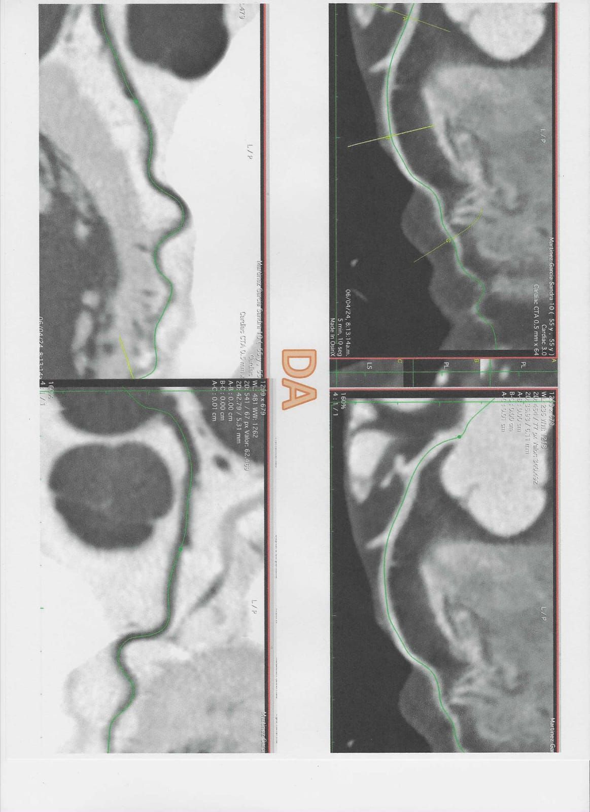 Luis Enrique Vera   Arroyo-8