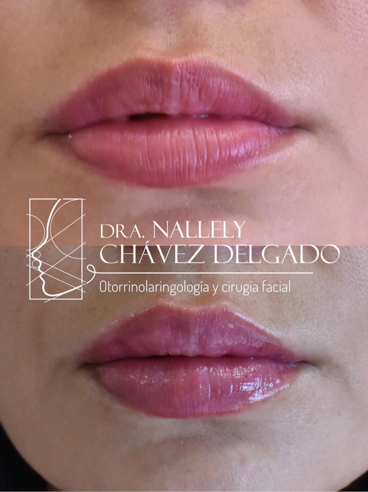 Nallely Chávez Delgado-6