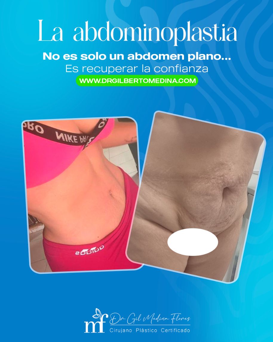 Gilberto Alfonso Medina Flores-6