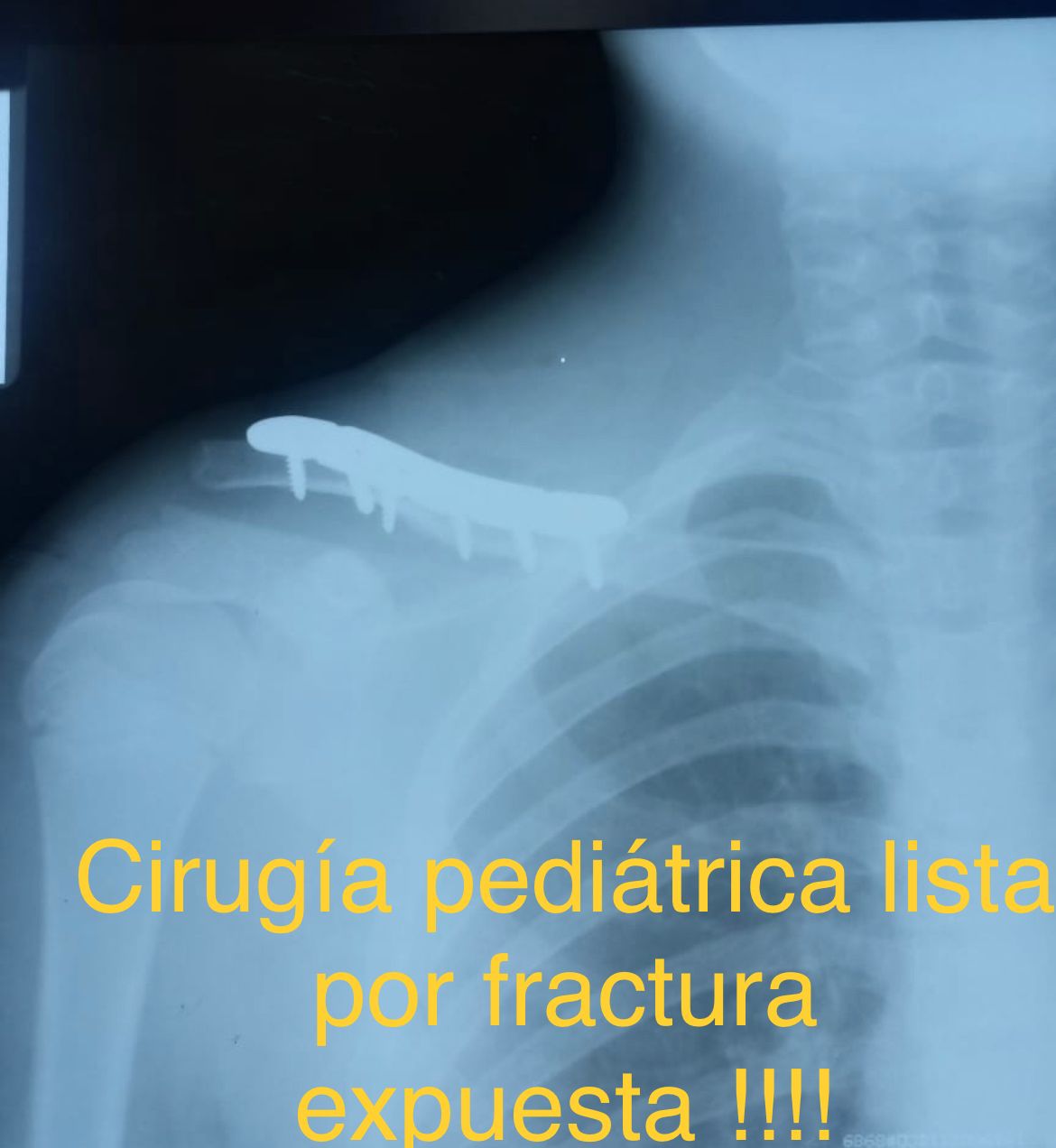 Emmanuel Bolaños Cortes-25