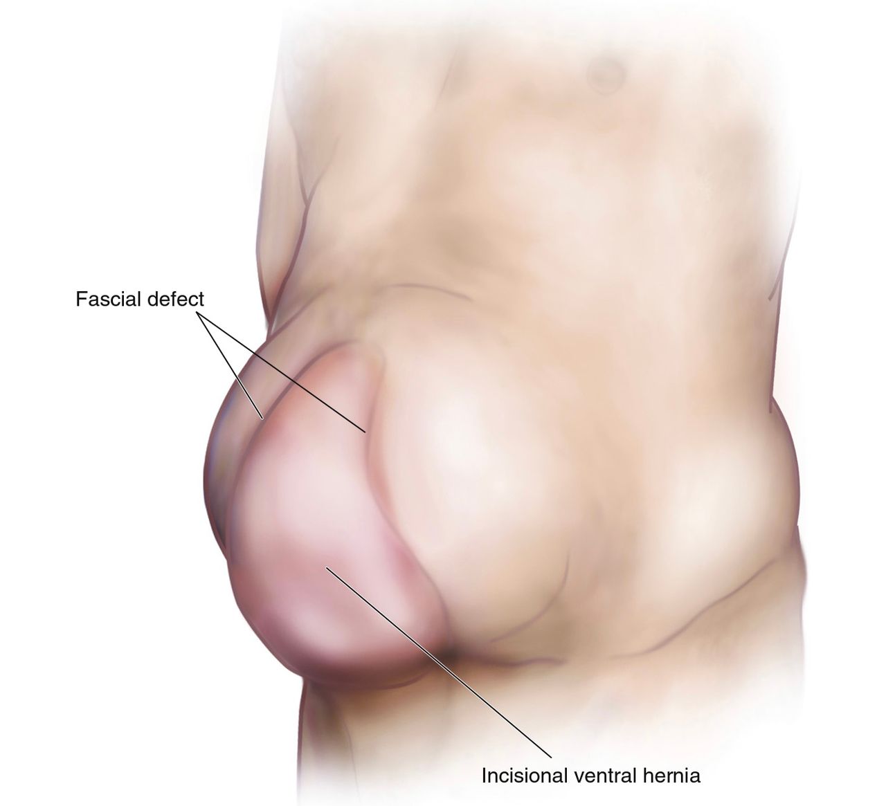 Mateo Ponciano Guerrero-14