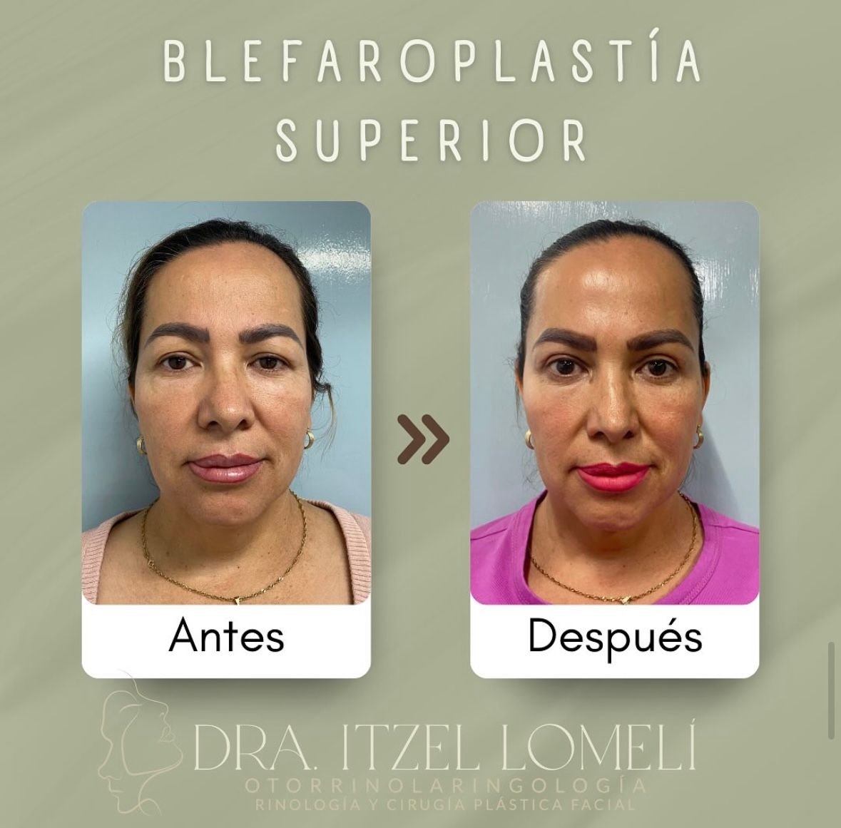 Itzel A Lomelí Gonzalez-3