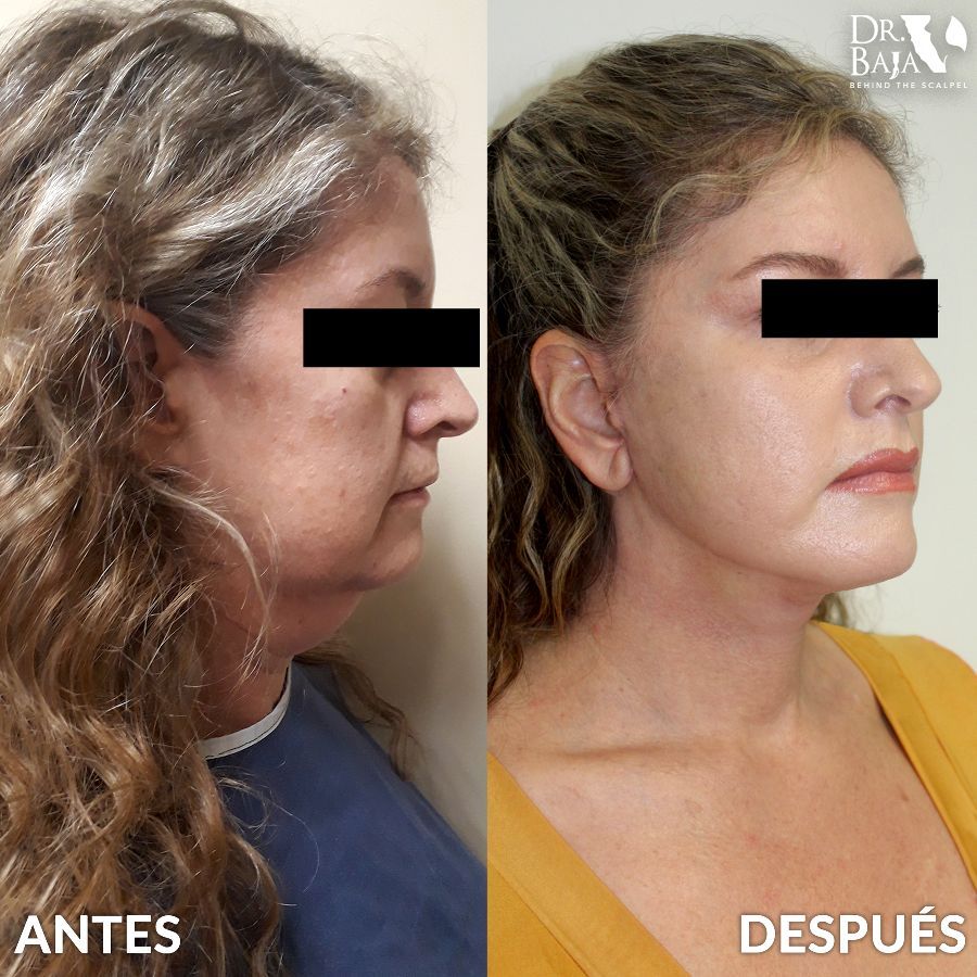 Renato Rodríguez Hirales-48