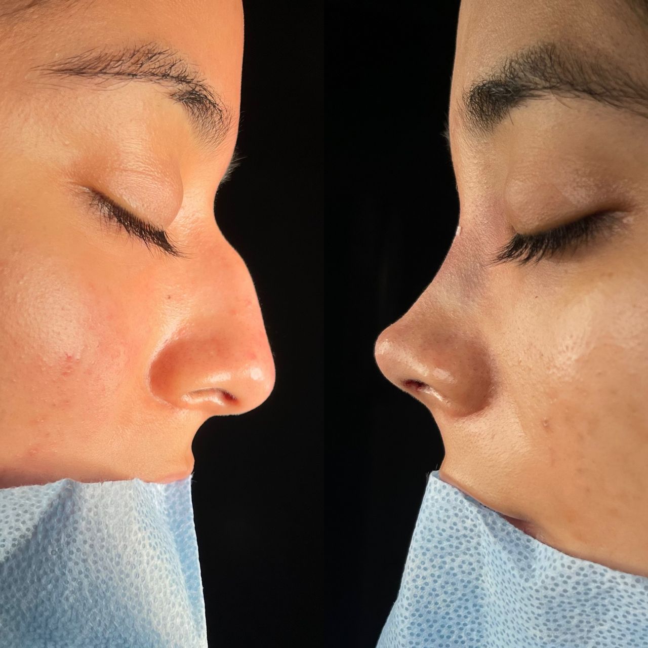 Angel Castro Urquizo-173