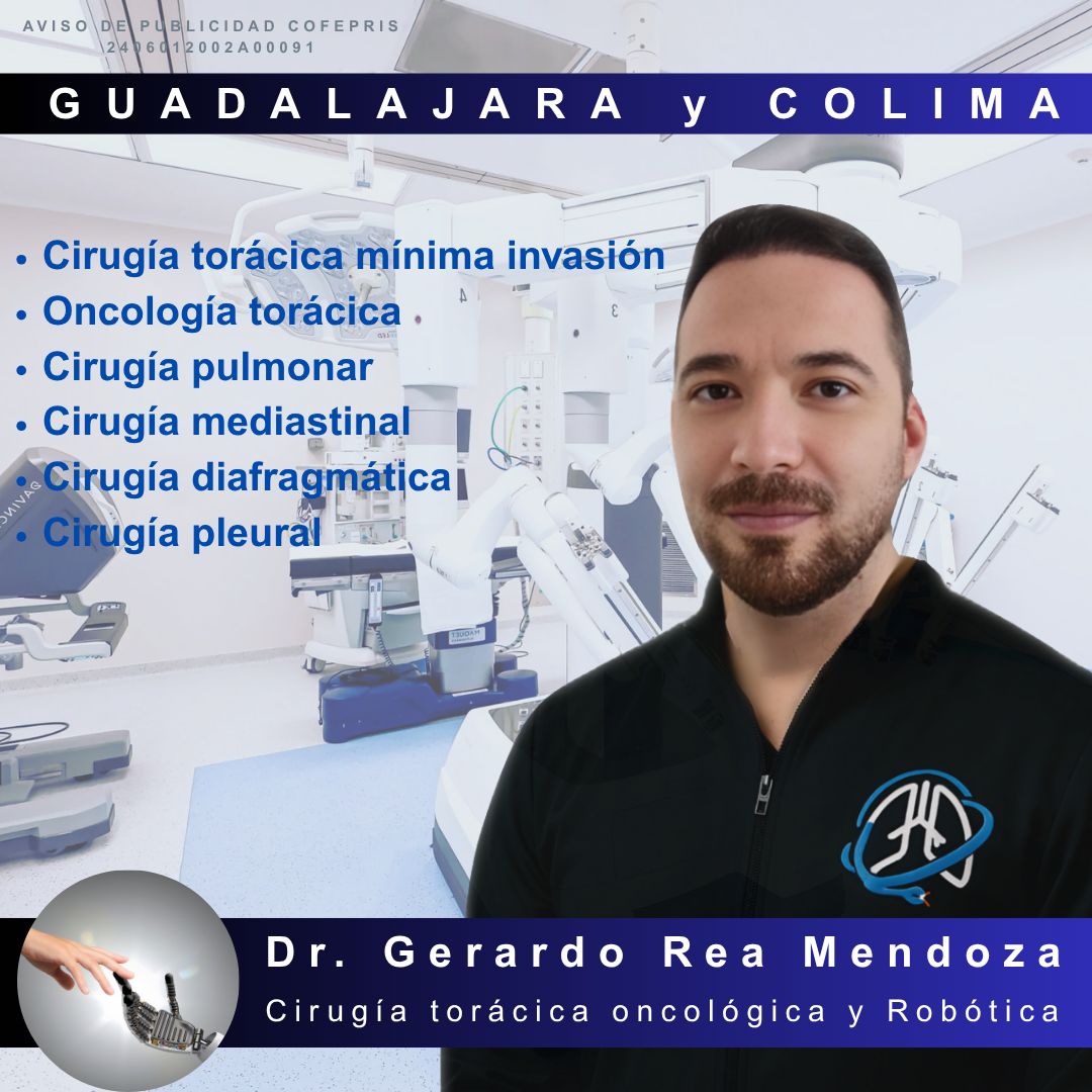 Gerardo Rea Mendoza-0