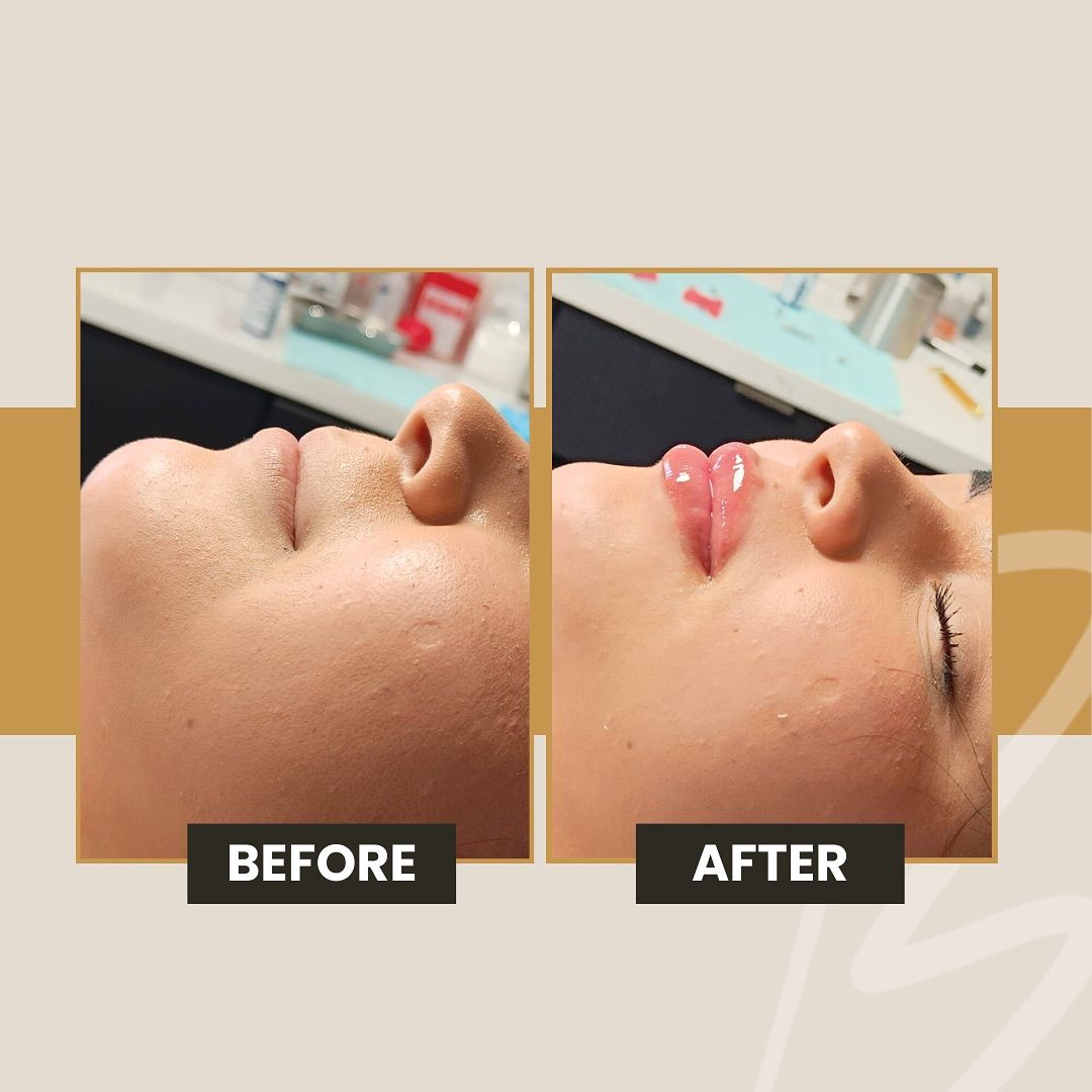 Gisel Areli Martinez Trejo-10