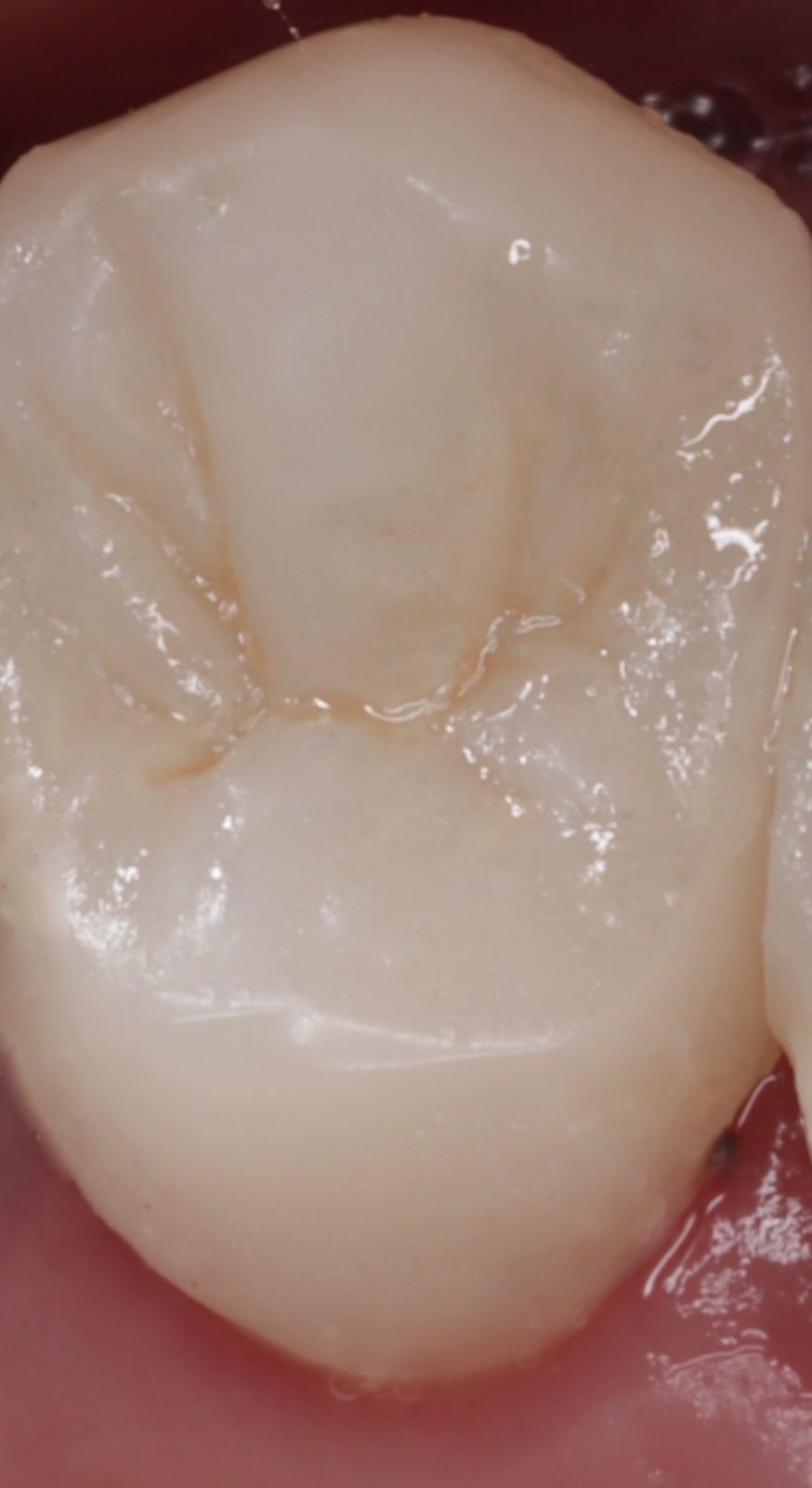 Fredy Alejandro Roblero Gónzalez-27