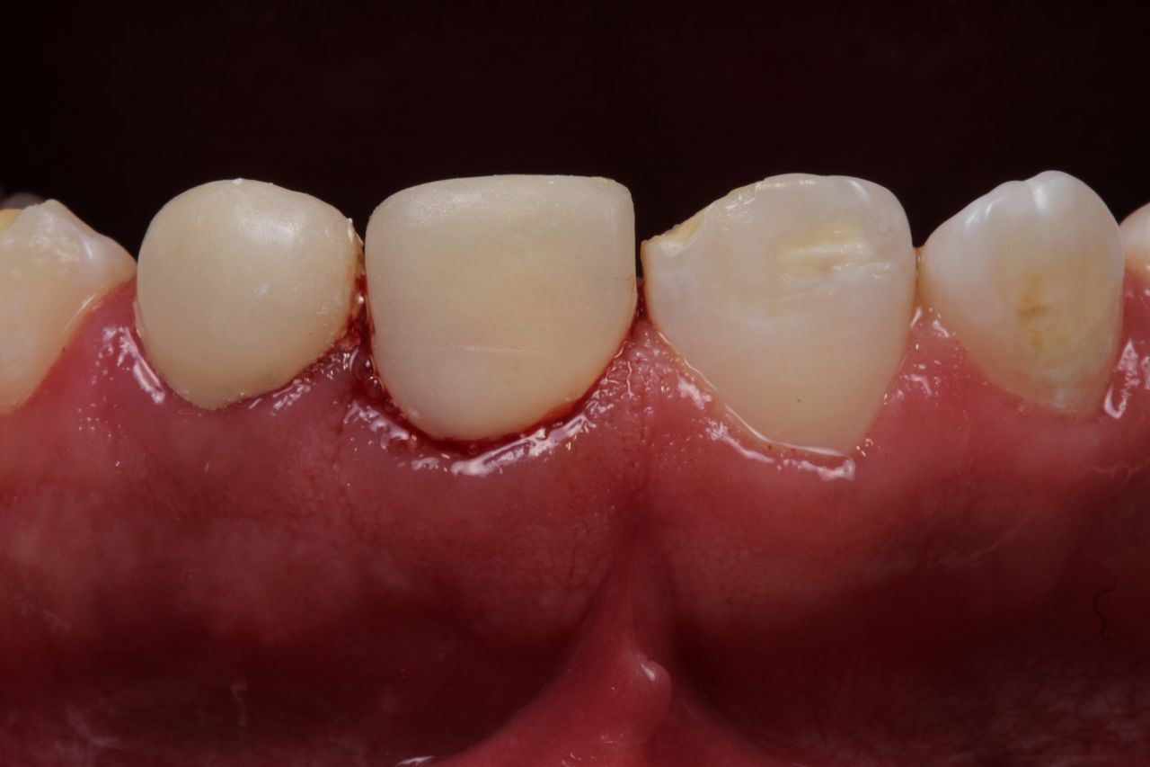 Fernando Fuentes Lozada-9