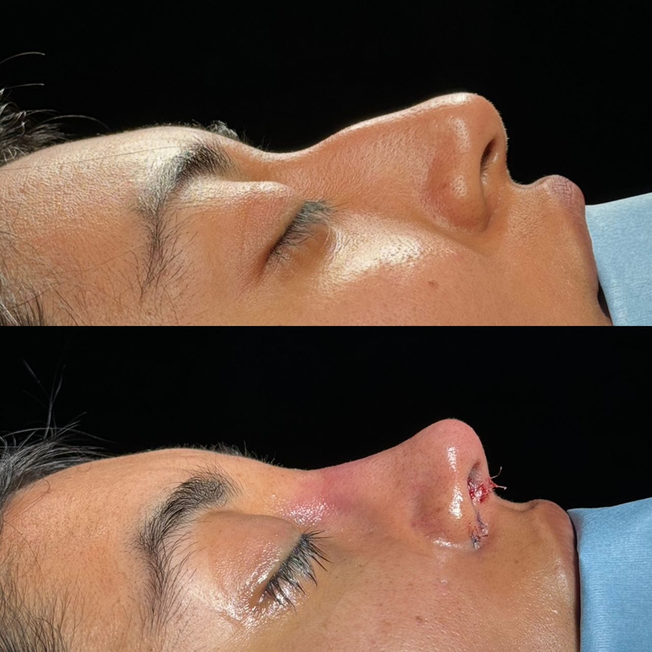 Angel Castro Urquizo-122