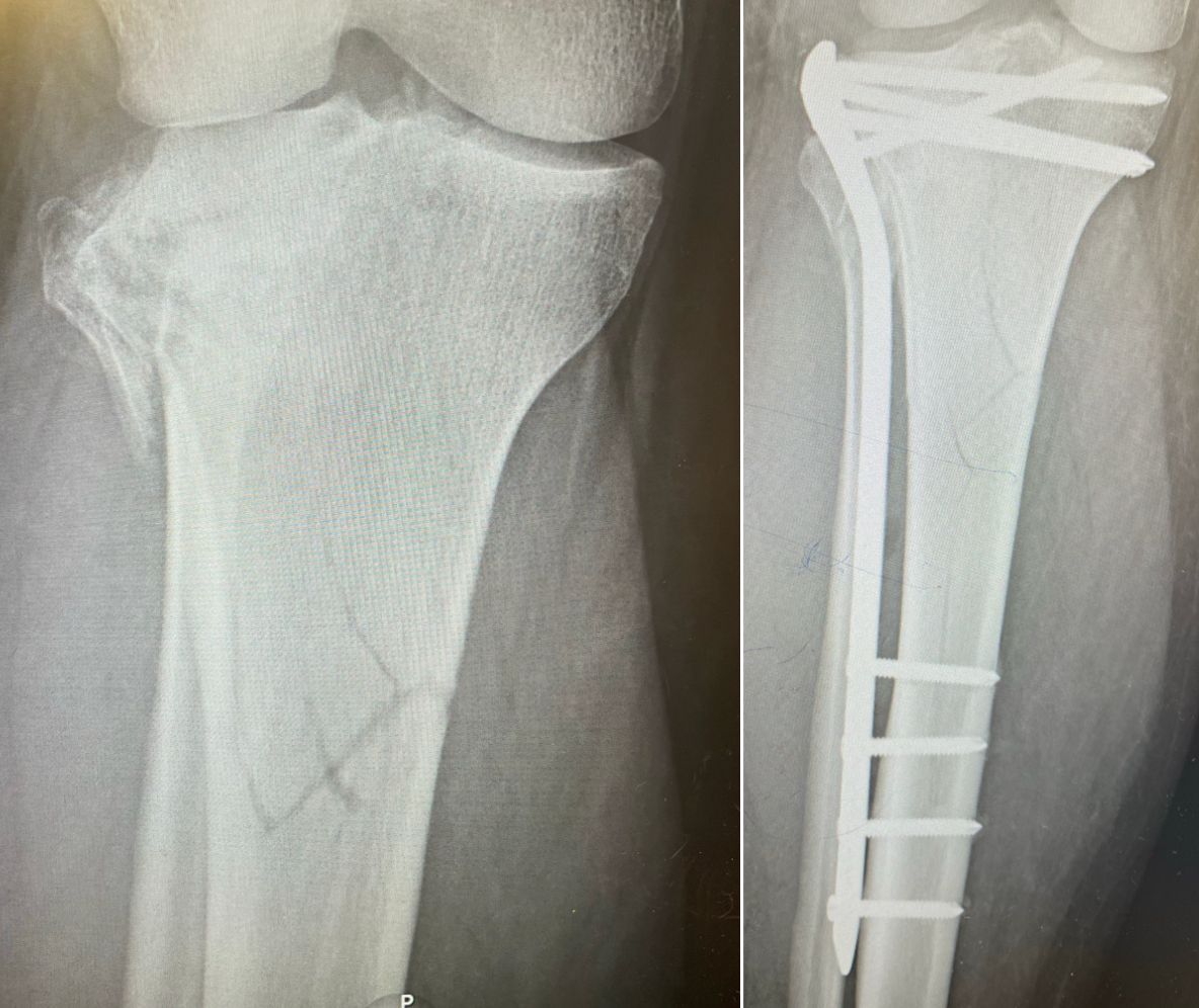 Diego Armando Contreras Rojas-15